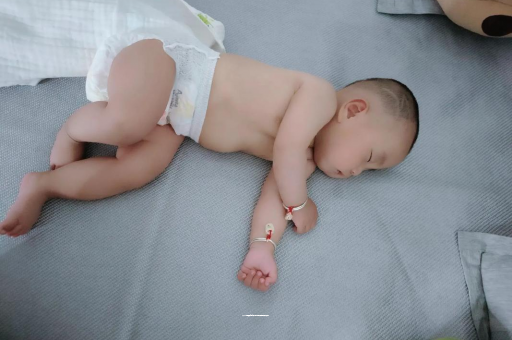 黄骅宝宝头上长痱子
